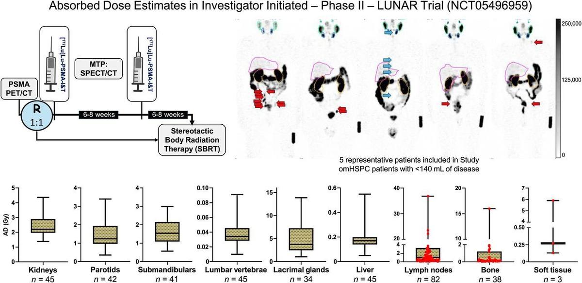 Dosimetry Analysis of 177Lu-PSMA-I&T in Patients with Low-Volume Oligometastatic Hormone-Sensitive Prostate Cancer: A Secondary Analysis of the LUNAR Trial.的论文原文Figure 1