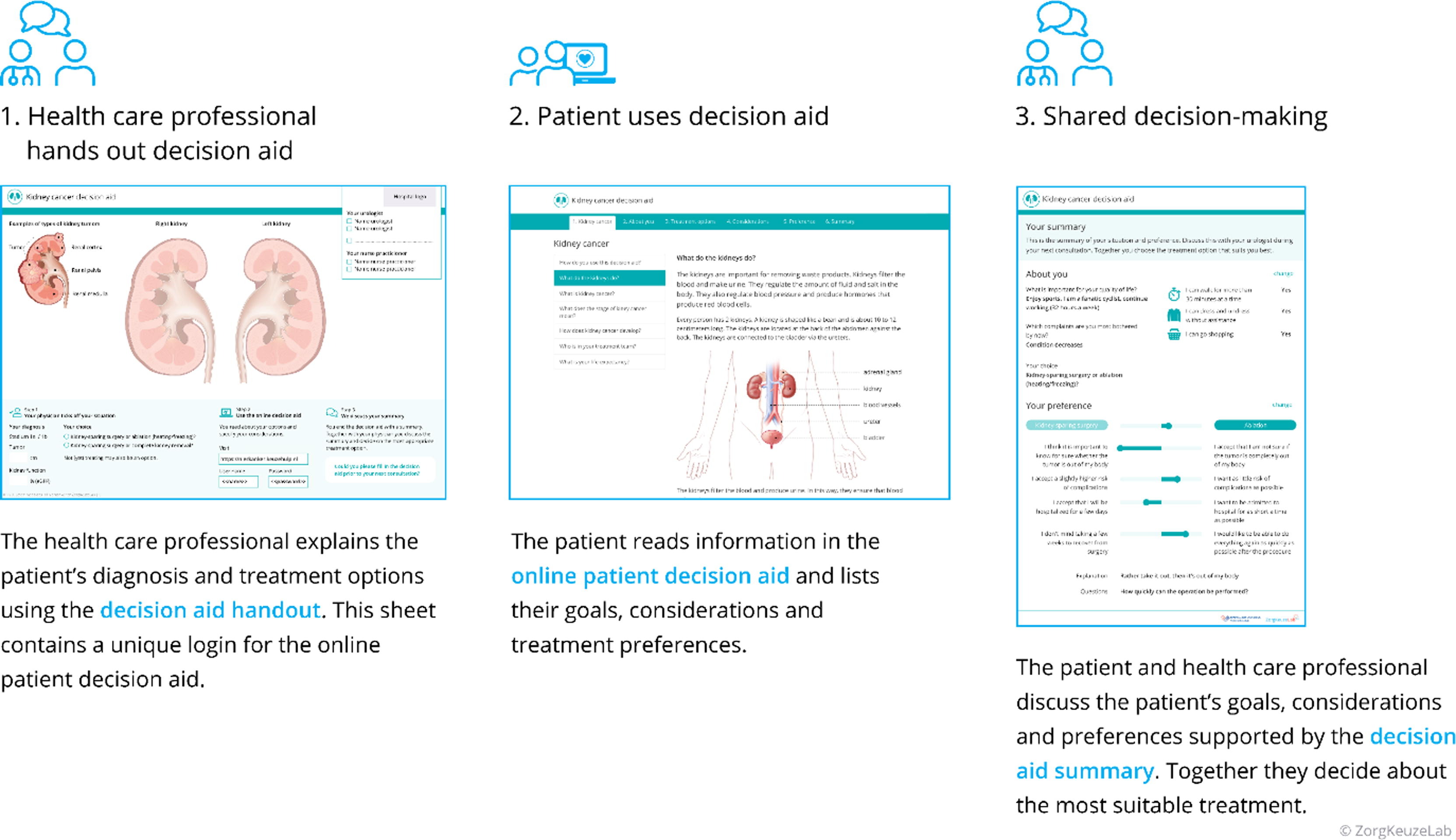 European Urology Oncology原文图，展示SDM-RCC共同决策工具从信息提供、价值澄清到医患共同选择的研究流程。