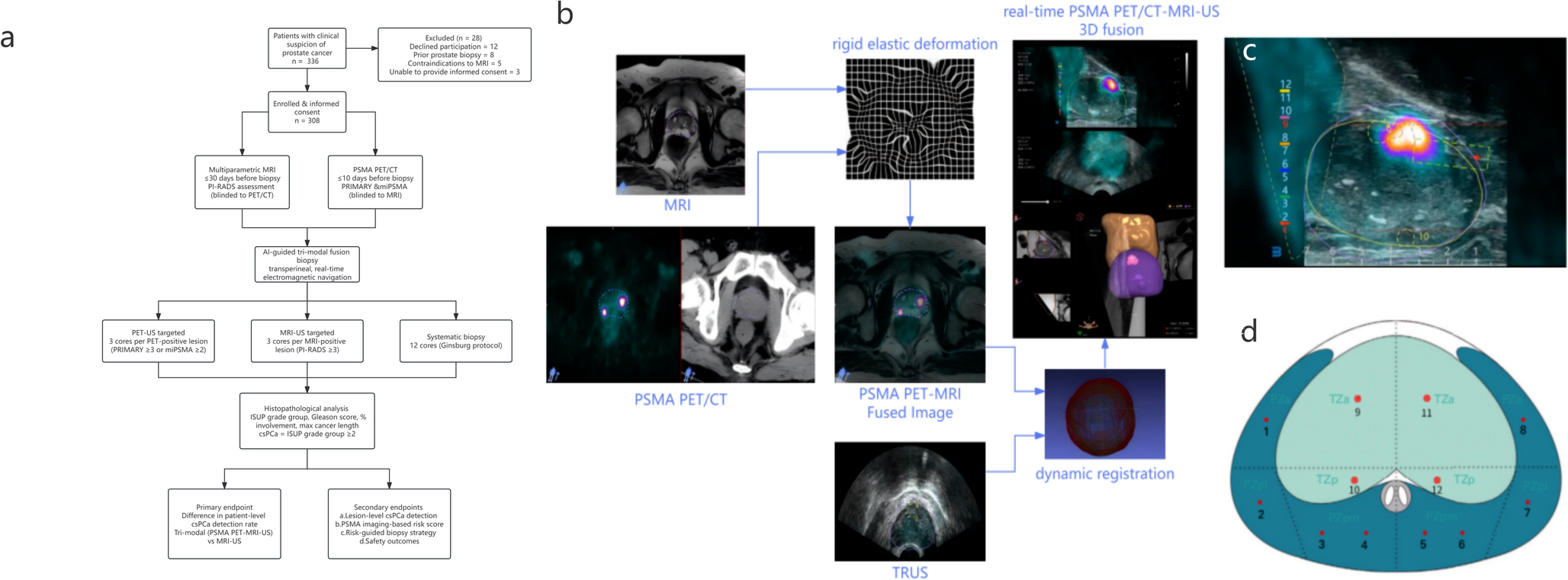 PSMA PET/CT、MRI与超声三模态融合活检的研究流程