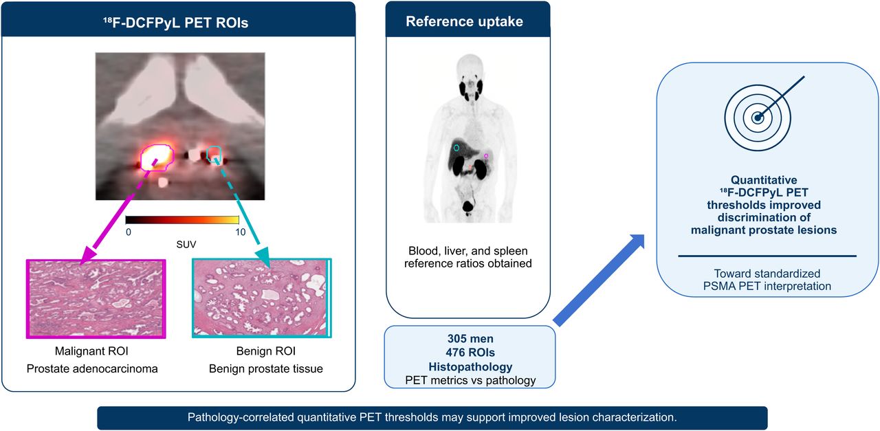 原文图形摘要：将PET感兴趣区与组织病理匹配，并评估血池、肝脏和脾脏校正的摄取参数。